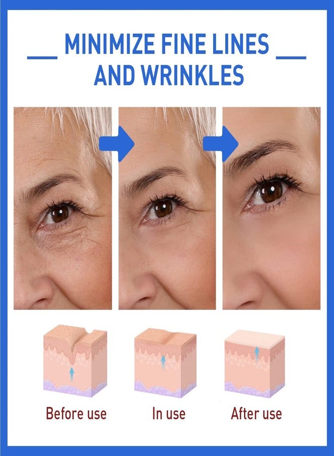 AKEASS 3pcs Face Serum: Stock Solution Facial Serum - in a Bottle, Instant Face Lift & Anti Aging Serum for Reduce Fine Lines, Wrinkles Skin - Image 4
